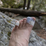 A bandaged hiker's foot after getting blisters on the trail. Find out how to prevent blisters when hiking, and how to treat blisters on the trail.