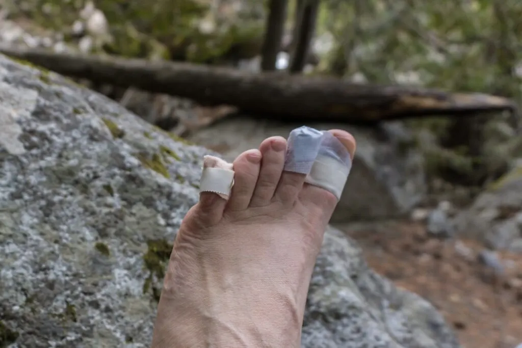 A bandaged hiker's foot after getting blisters on the trail. Find out how to prevent blisters when hiking, and how to treat blisters on the trail.