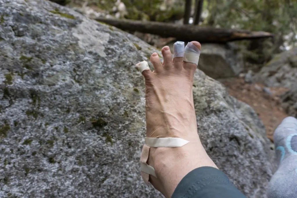 A hiker's foot with several kinds of bandages after getting blisters on the trail. Find out how to prevent blisters when hiking, and how to treat blisters on the trail.